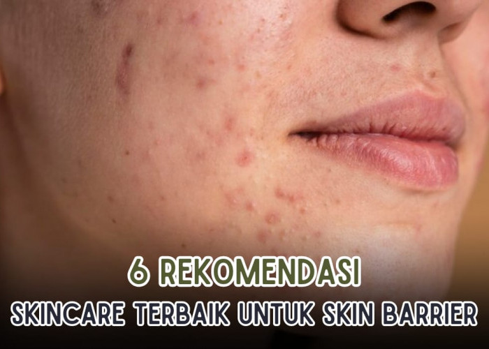 6 Rekomendasi Skincare Terbaik Untuk Skin Barrier, Pulihkan Kulit yang Rusak Akibat Krim Abal-Abal!