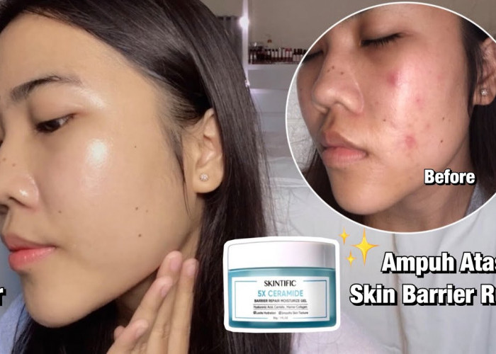 Cara Mengatasi Kulit Sensitif dan Breakout: Moisturizer Andalan Aku!