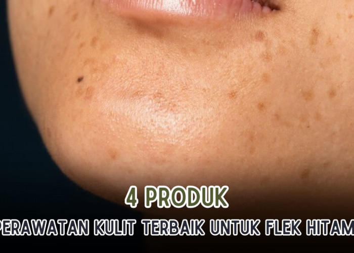 4 Produk Perawatan Kulit Terbaik Atasi Flek Hitam, Dijamin Noda Hitam Tersamarkan dalam 7 Hari!   