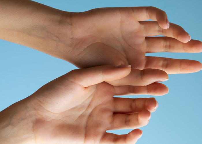 Telapak Tangan Kuning, Benarkah Penyakit Berbahaya? Simak Penjelasannya