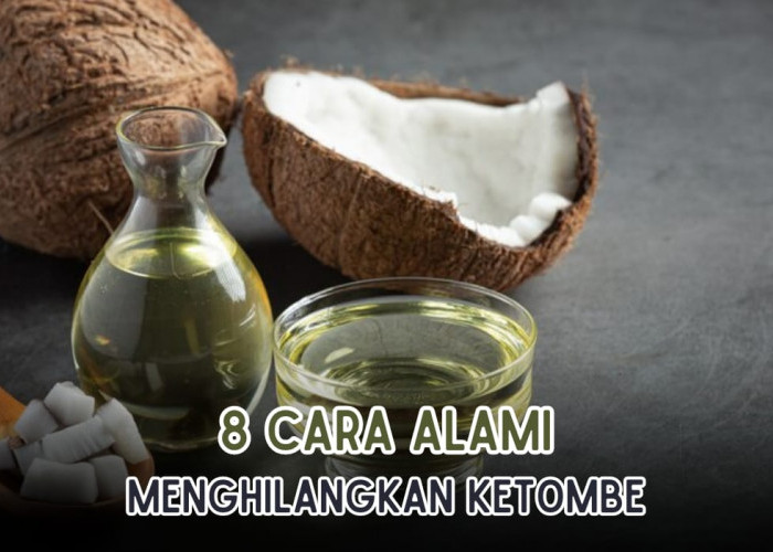 Bahan Alami Lebih Ajib, Ini 8 Cara Menghilangkan Ketombe Membandel, Hitungan Hari Langsung Hilang!