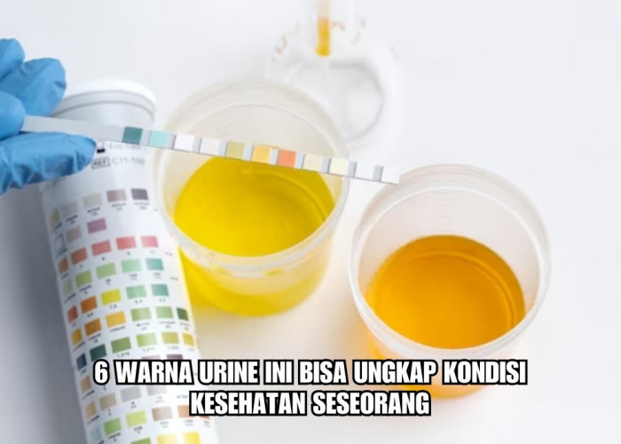 6 Warna Urine Ini Bisa Ungkap Kondisi Kesehatan Seseorang, Pertanda Penyakit Apa?
