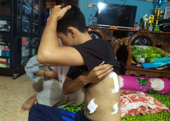 Gegara Tegur Orang Rusak Hiasan 17 Agustus, Pemuda di Palembang Ditusuk