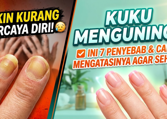 Bikin Kurang Percaya Diri! Ini 7 Penyebab Kuku Menguning serta Cara Mengatasinya agar Kuku Tampak Lebih Sehat