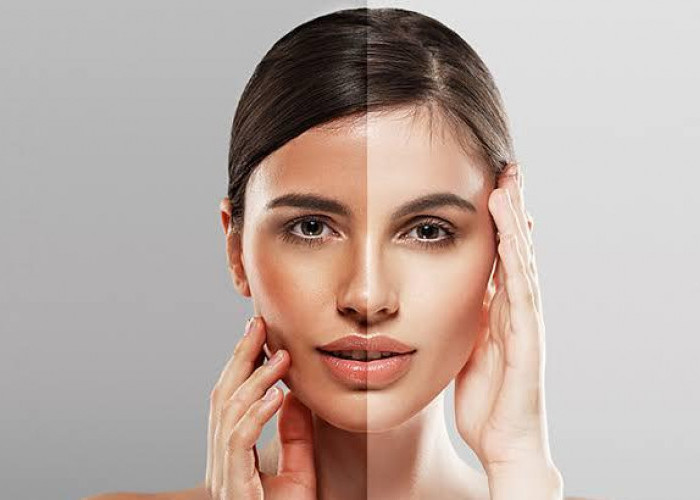 Sayonara Kulit Belang, Ini 6 Brand Skincare yang Paling Ampuh Meratakan Warna Kulit