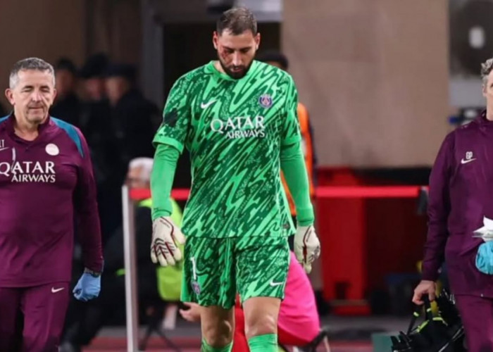 Fakta dan Kabar Terbaru Gianluigi Donnarumma Setelah Mengalami Cedera Wajah