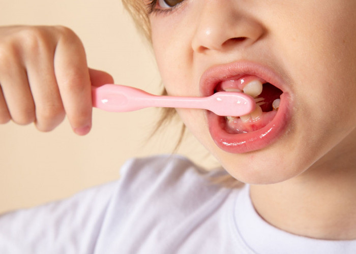 Apa Itu Karies Gigi? Kebiasaan Ini yang Bisa Sebabkan Karies Gigi Pada Anak