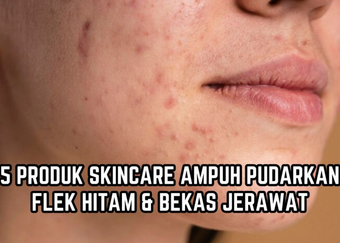 5 Skincare yang Ampuh Pudarkan Flek Hitam dan Bekas Jerawat, Bikin Wajah Kusam Jadi Cerah