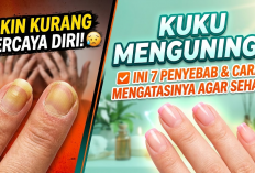 Bikin Kurang Percaya Diri! Ini 7 Penyebab Kuku Menguning serta Cara Mengatasinya agar Kuku Tampak Lebih Sehat